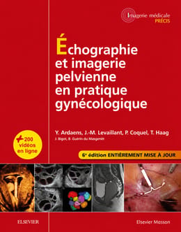 Guide Complet d'Échographie Pelvienne en Gynécologie – Diagnostic Précis