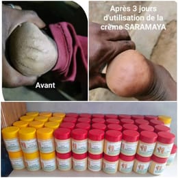 Pied sec et fissuré
