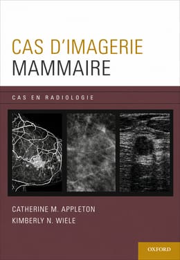 CAS D'IMAGERIE MAMMAIRE PDF FILE