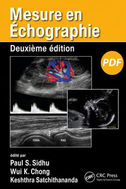Mesure en Échographie – Deuxième édition (PDF)