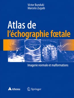 Atlas de l'échographie fœtale
