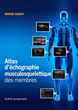 Atlas d’Échographie Musculosquelettique des Membres