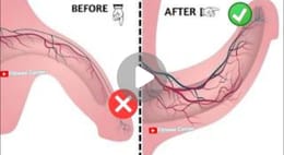Réveil de la Puissance Masculine – Exercices 100% Naturels