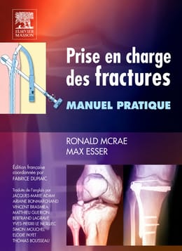 Prise en charge des fractures