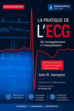 La pratique de L’ECG