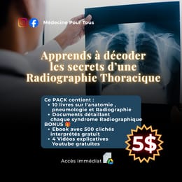 PACK Rx Thorax: Apprenez à Lire les Clichés comme un Pro