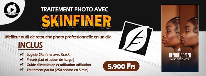 Pro SkinFiner V5 : Boostez Vos Revenus Photo
