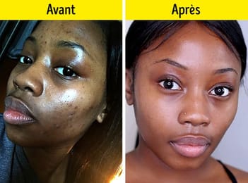 MODULE 1:Formation des huiles de soin bio