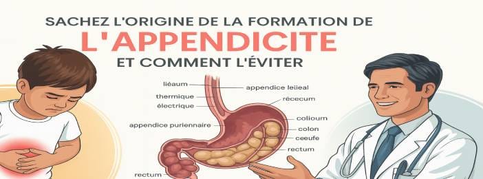 L’Origine de l’Appendicite et Comment l’Éviter – Guide Complet de Prévention et de Santé Digestive