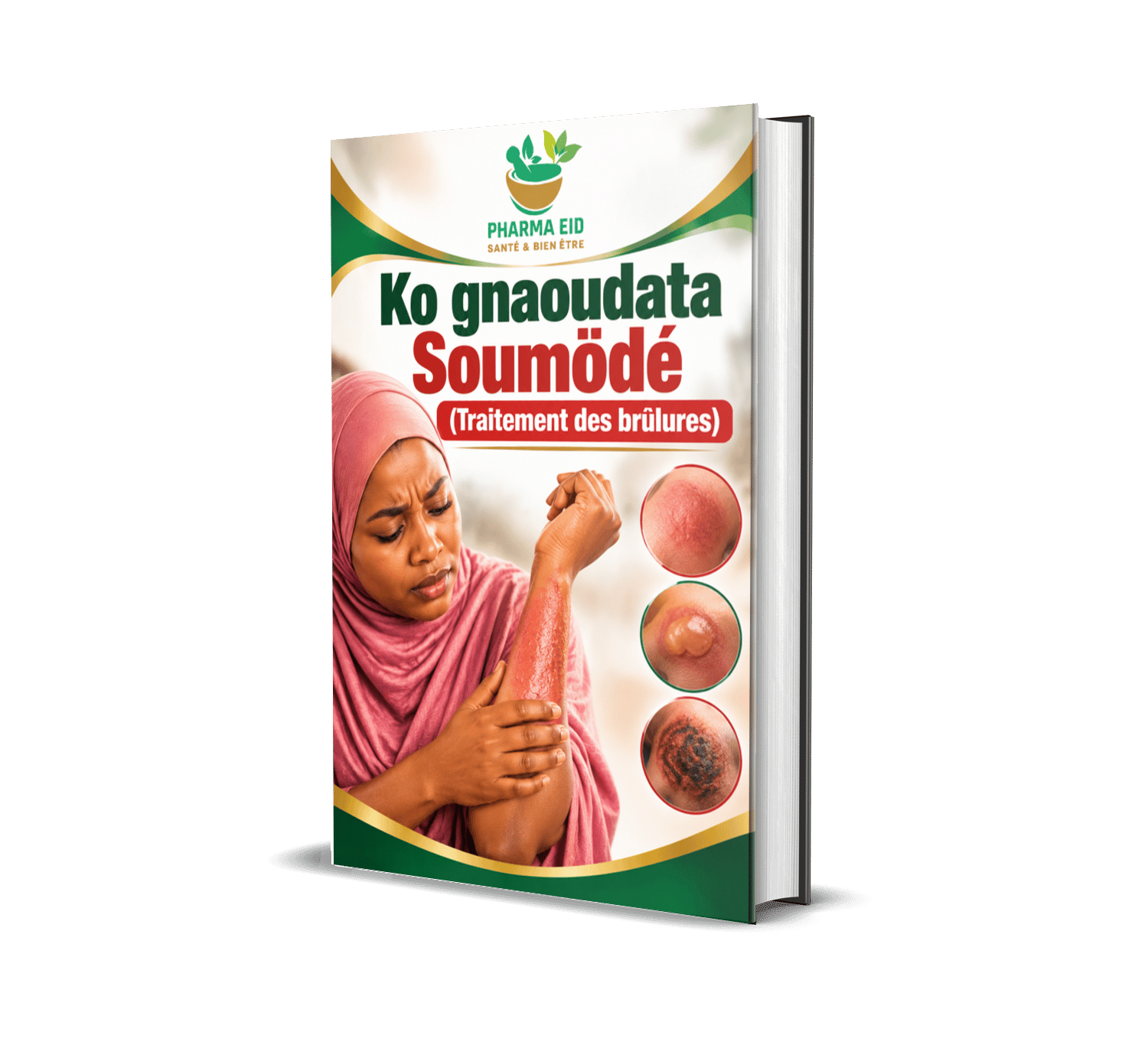 Ko gnaoudata Soumödé (Traitement des brûlures)