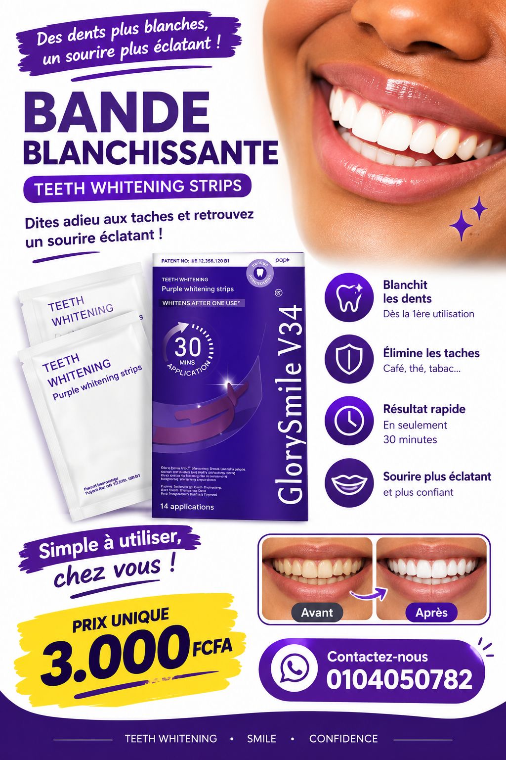 Adieu aux dents jaunes 😌