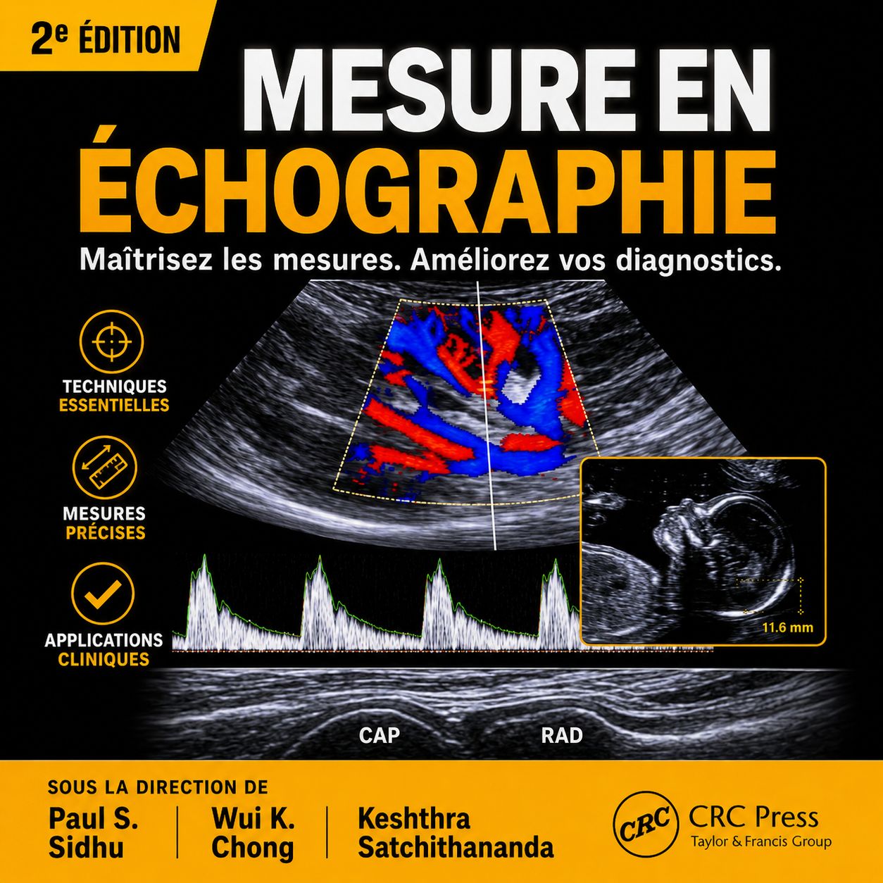 La référence incontournable pour maîtriser les mesures en échographie