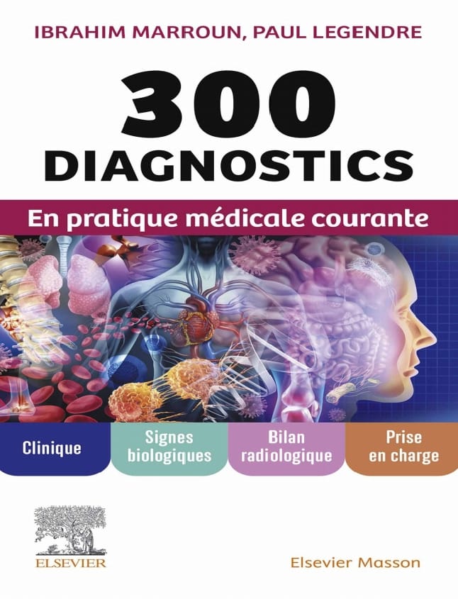 300 DIAGNOSTICS
