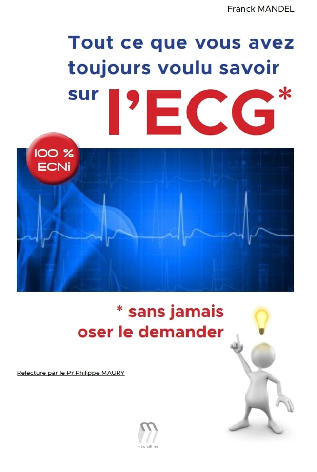 Tout ce que vous avez toujours voulu savoir sur l’ECG* * sans jamais oser le demander