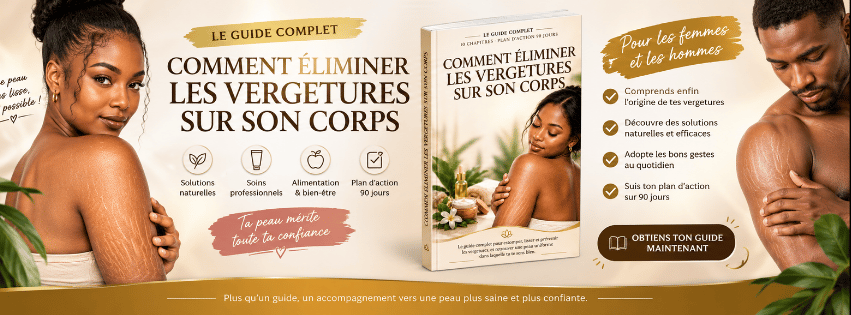 Comment éliminer les vergetures sur son corps