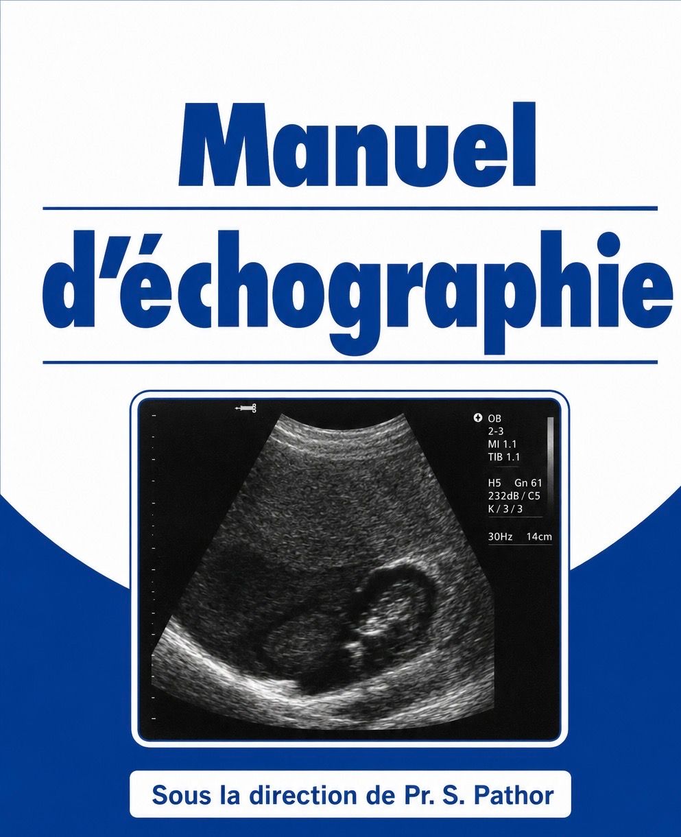 Manuel D’Echographie