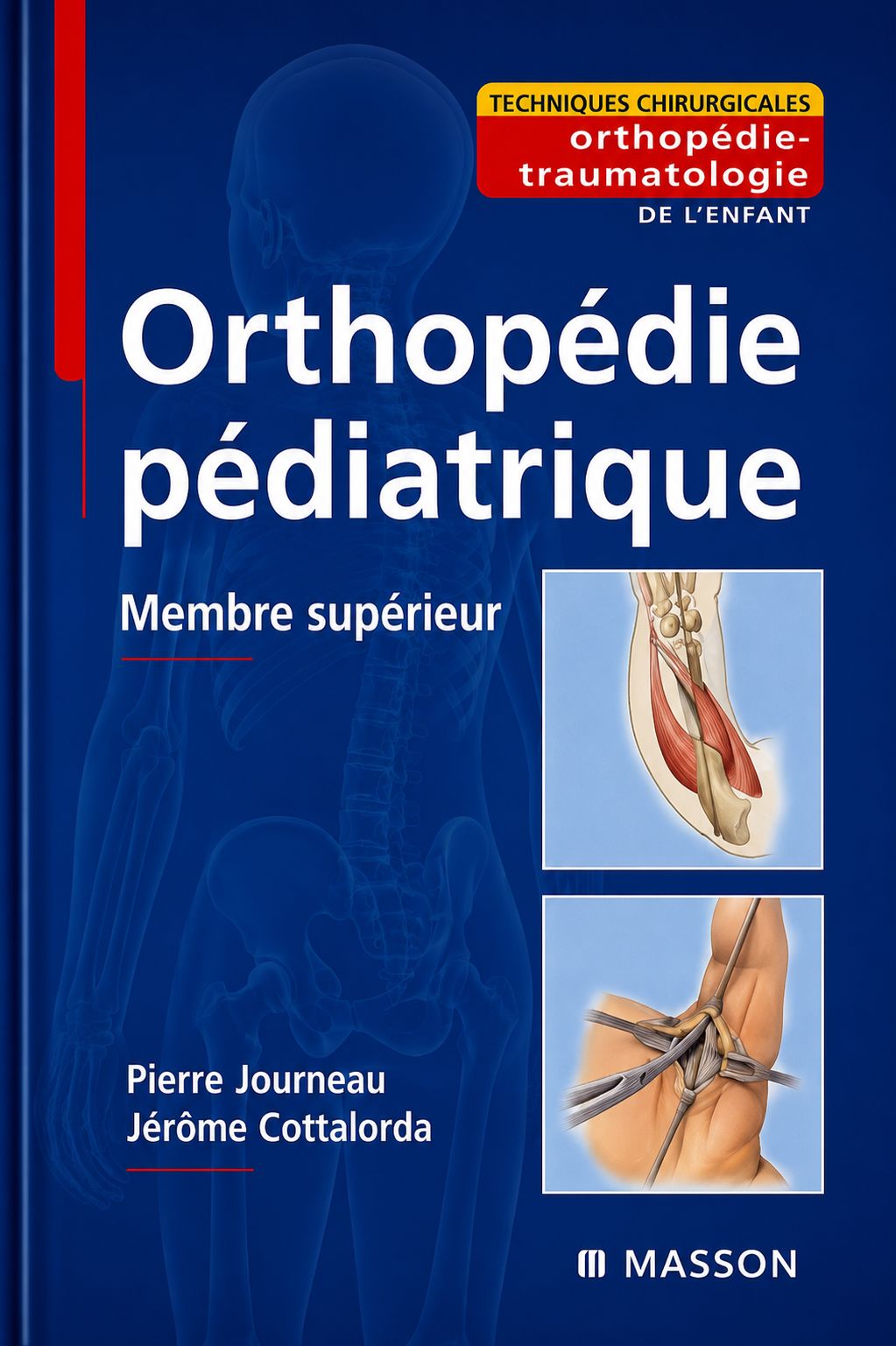 Orthopédie pédiatrique