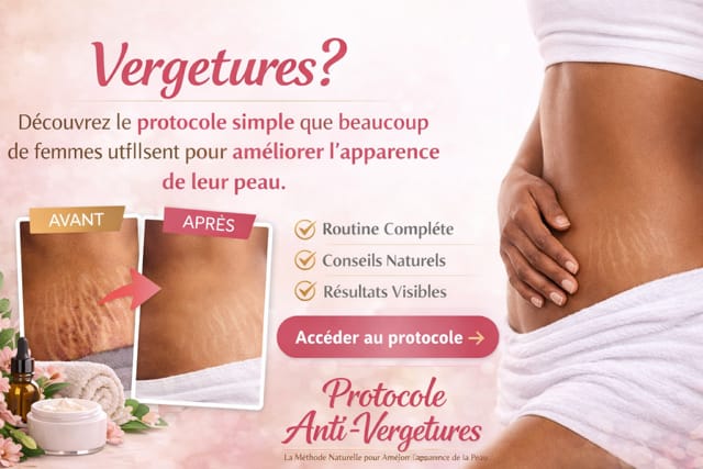 Vergetures : Le Protocole Naturel pour Améliorer l’Apparence de Votre Peau
